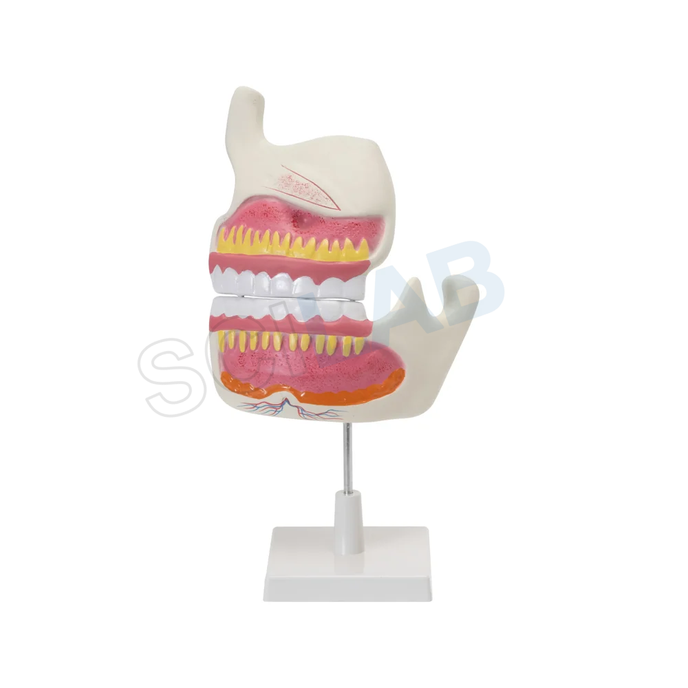 Human Upper & Lower Jaw