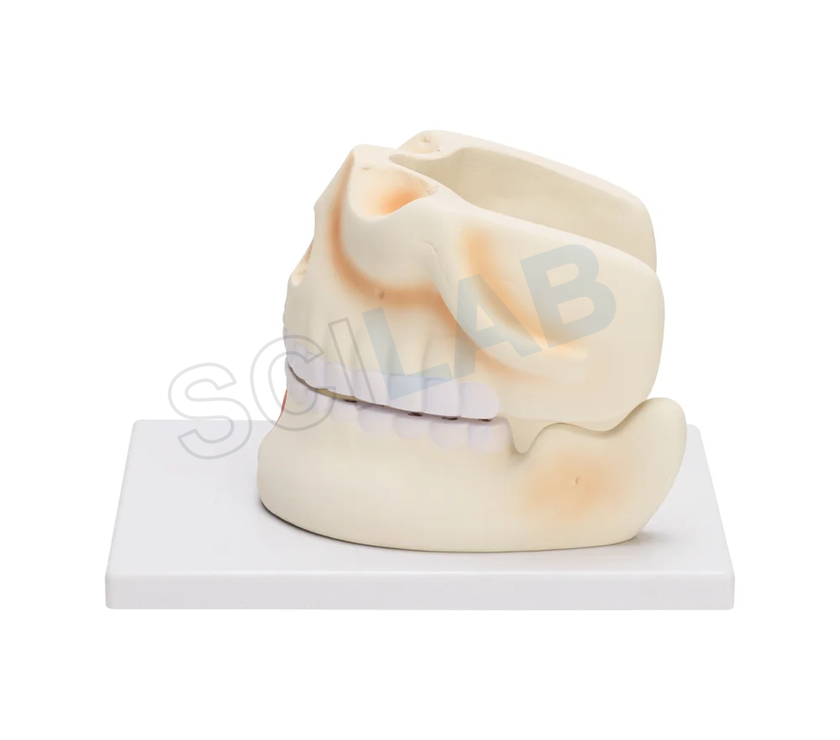 Human Upper & Lower Jaw