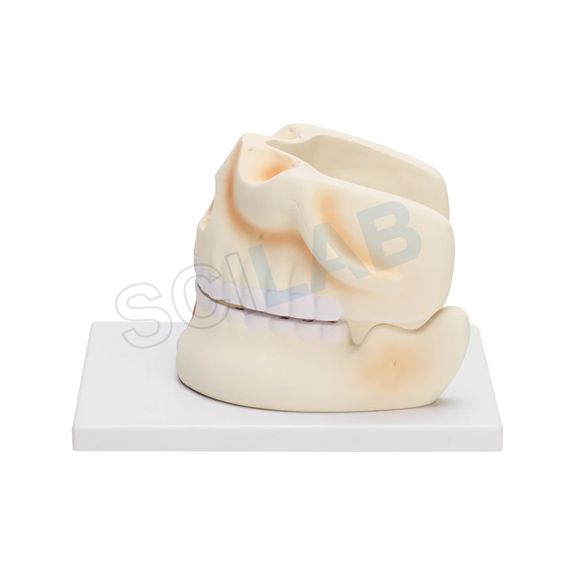 Human Upper & Lower Jaw