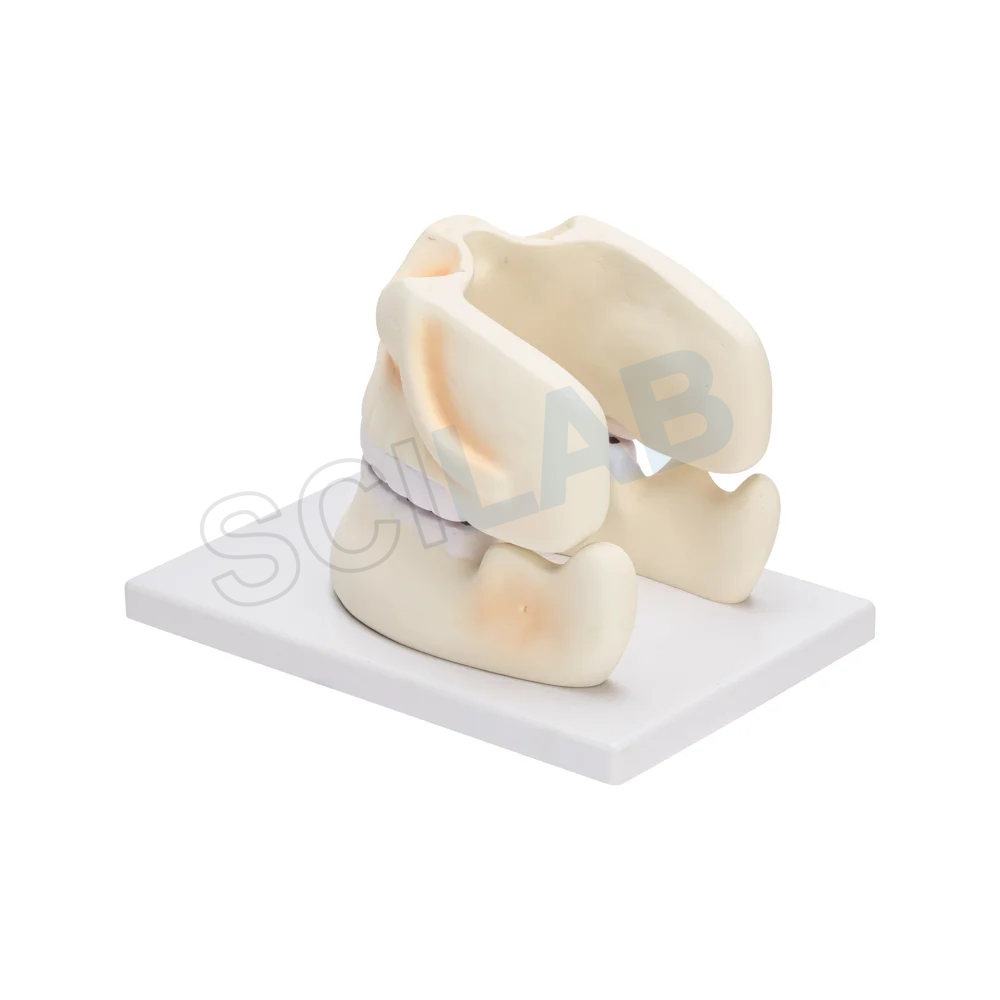 Human Upper & Lower Jaw