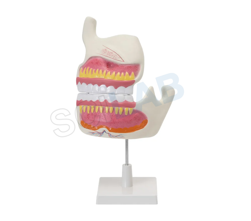 Human Upper & Lower Jaw