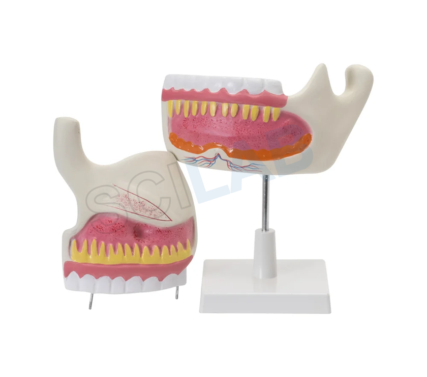 Human Upper & Lower Jaw