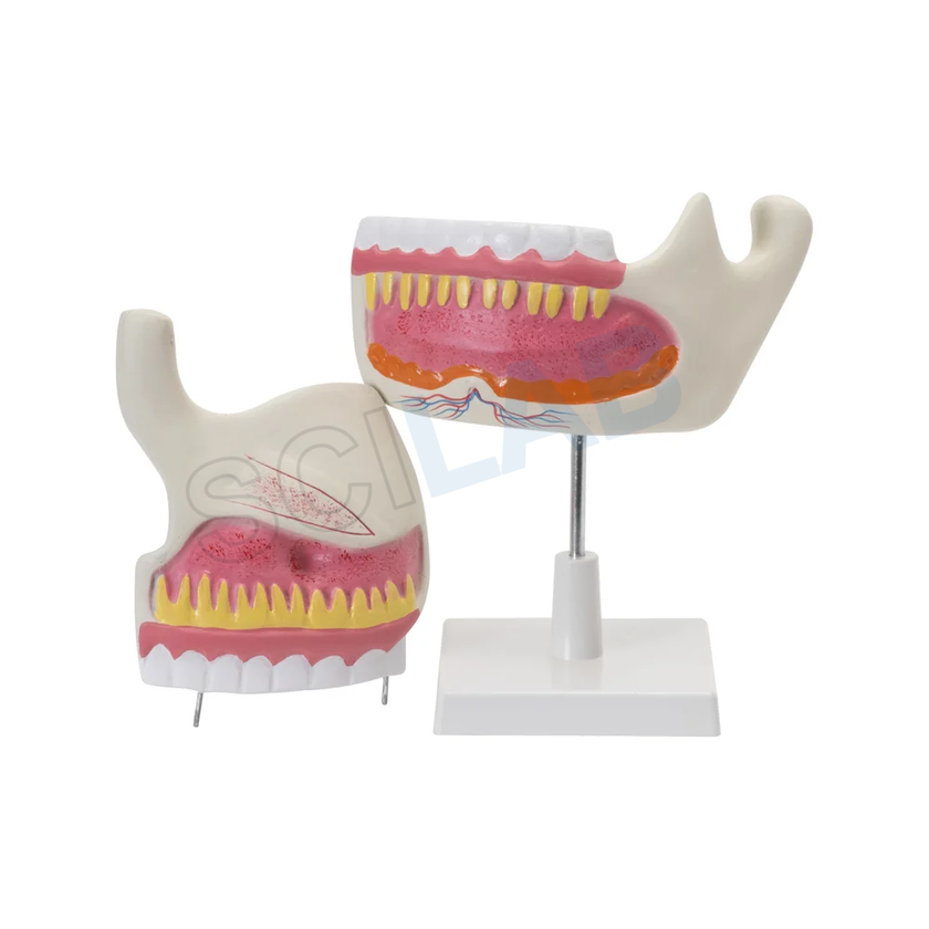 Human Upper & Lower Jaw