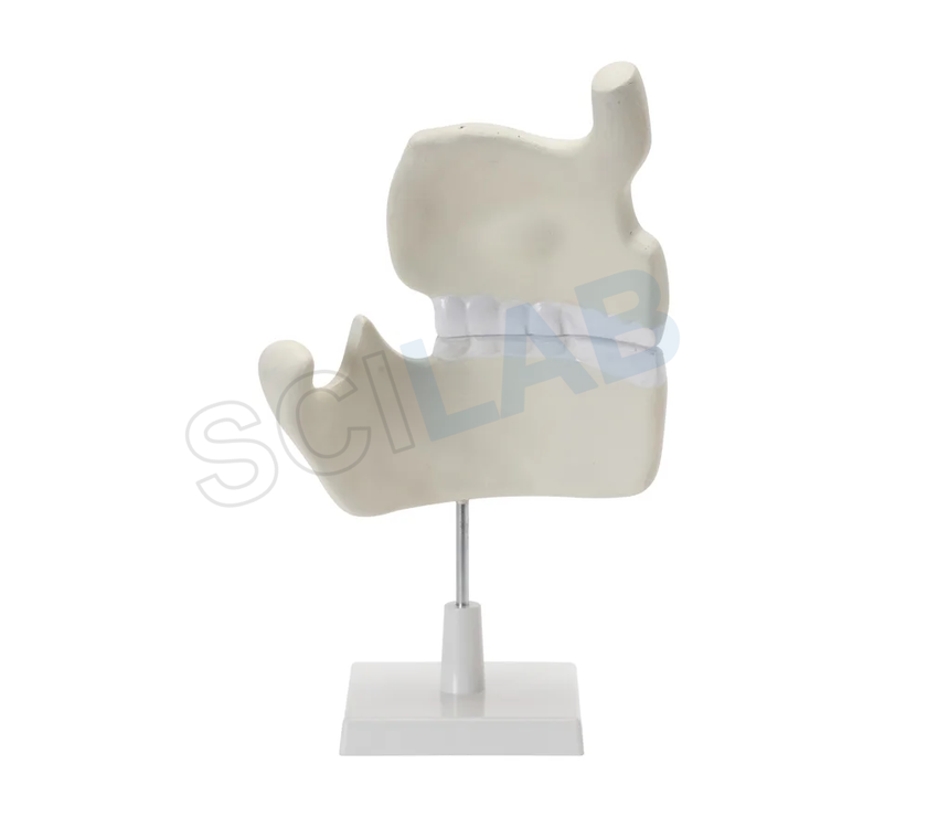 Human Upper & Lower Jaw