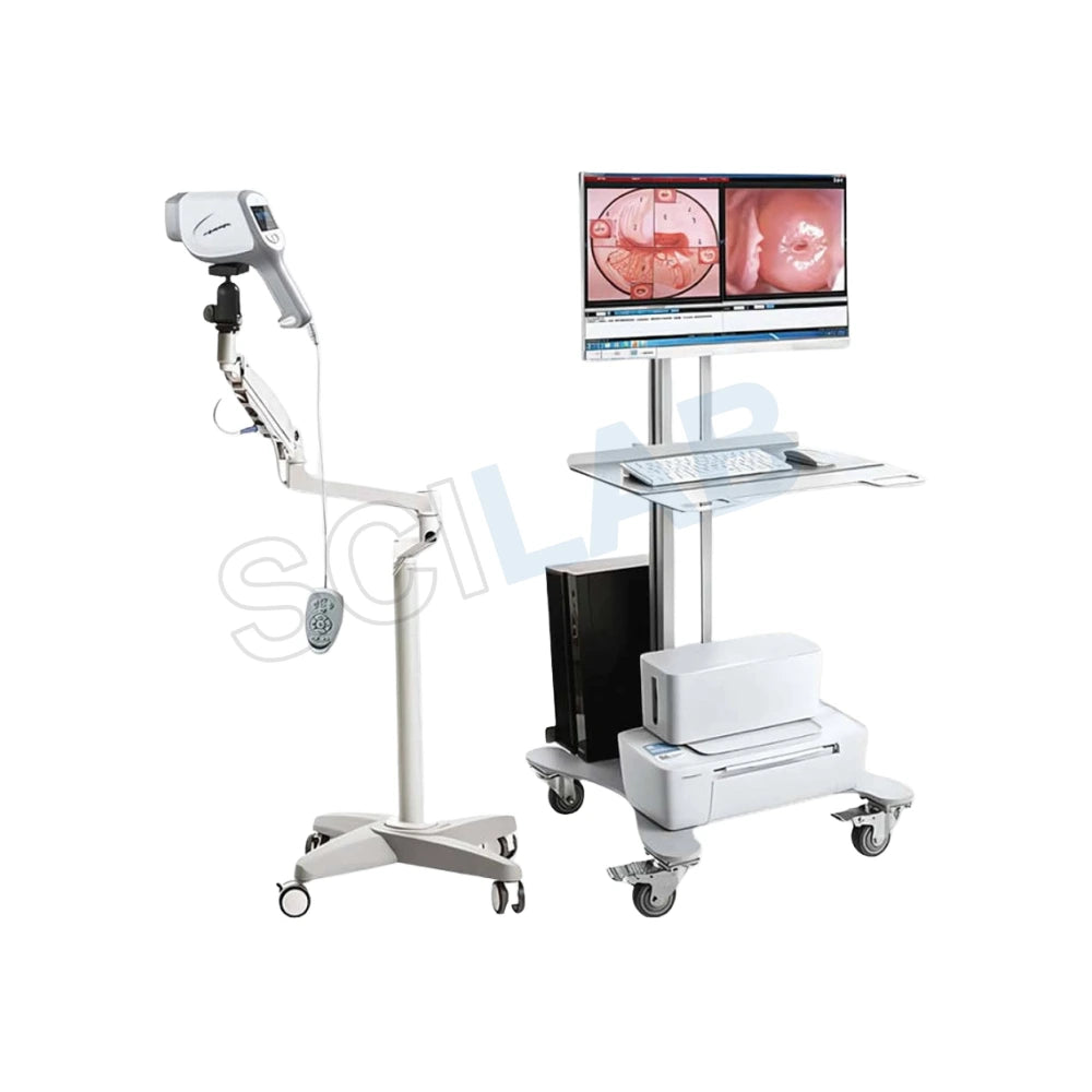 Colposcope: Full HD Digital Video for Gynecology